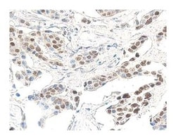 p53 Mouse anti-Human, Unlabeled, Clone: PAB 1801, BD:Antibodies:Primary