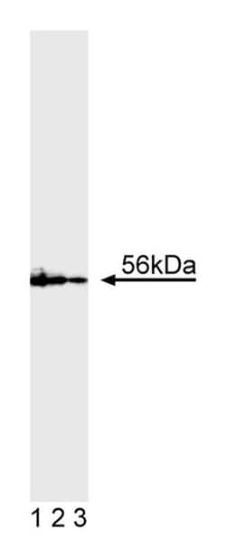 Lck with control Mouse anti-Human, Unlabeled, Clone: MOL 171, BD:Antibodies:Primary