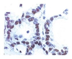 p53 Mouse anti-Human, Unlabeled, Clone: DO-7, BD 0.1mg; Unlabeled:Antibodies,