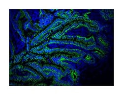 E-Cadherin Mouse, Alexa Fluor 647, Clone: 36/E-Cadherin, BD 100 tests;