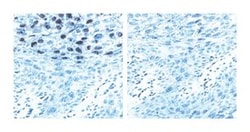 L1 Protein of Human Papilloma Virus Mouse anti-Human, Unlabeled, Clone: CAMVIR-1, BD 0.1 mg | Buy Online | BD Biosciences | Fisher Scientific