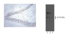 Serotonin Receptor 5-HT2BR Mouse, Unlabeled, Clone: A72-1, BD 0.1mg; Unlabeled:Antibodies,