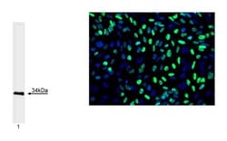 Myogenin Mouse, Unlabeled, Clone: F5D, BD 0.1mg; Unlabeled:Antibodies,