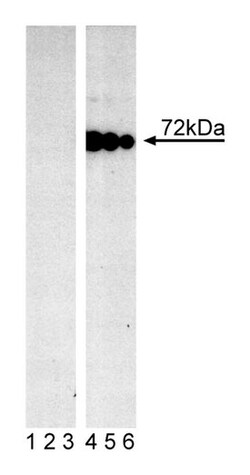 Syk (pY348) Mouse, Unlabeled, Clone: I120-722, BD 50 &mu;g | Buy Online | BD Biosciences | Fisher Scientific