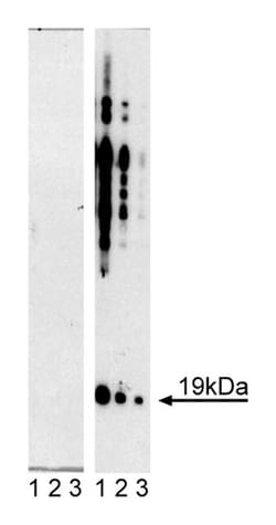 -Synuclein (pY125) Mouse anti-Human, Unlabeled, Clone: I57-628, BD 0.1mg;