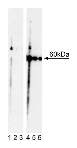 Akt (pT308) Mouse, Unlabeled, Clone: J1-223.371, BD 0.1mg; Unlabeled:Antibodies,