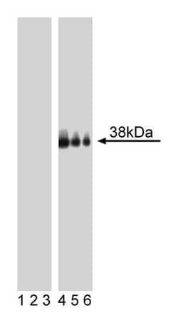 LAT (pY226) Mouse anti-Human, Unlabeled, Clone: J96-1238.58.93, BD 0.1mg;