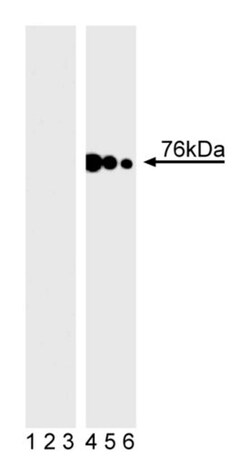 SLP-76 (pY128) Mouse anti-Human, Unlabeled, Clone: J141-668.36.58, BD 0.1mg;