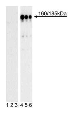 IRS-1 (pY896) Mouse anti-Human, Unlabeled, Clone: K9-211, BD 0.1mg; Unlabeled:Antibodies,