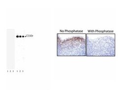 EGF Receptor (pY1173) Mouse, Unlabeled, Clone: 9H2, BD 0.1mg; Unlabeled:Antibodies,