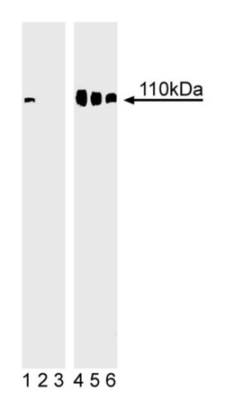 Rb (pS780) Mouse anti-Human, Unlabeled, Clone: J146-35, BD 0.1mg; Unlabeled:Anticuerpos