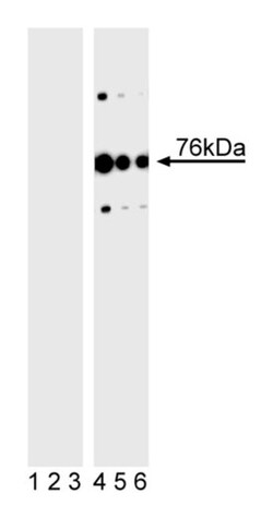 SLP-76 (pY113) Mouse anti-Human, Unlabeled, Clone: J80-373, BD 0.1mg; Unlabeled:Antibodies,