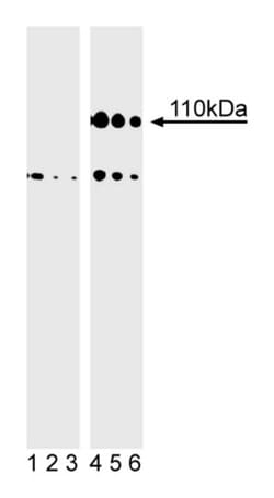 Rb (pS807/pS811) Mouse anti-Human, Unlabeled, Clone: J112-906, BD 0.1mg;