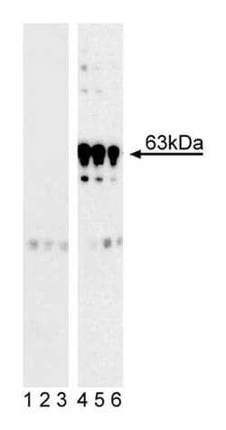 PDPK1 (pS241) Mouse, Unlabeled, Clone: J66-653.44.22, BD 0.1mg; Unlabeled:Antibodies,