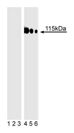 TBK1 (pS172) Mouse, Unlabeled, Clone: J133-1171, BD 0.1mg; Unlabeled:Antibodies,