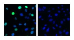 ATM (pS1981) Mouse, Unlabeled, Clone: K88-534, BD 0.1 mg | Buy Online | BD Biosciences | Fisher Scientific