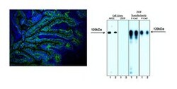 E-Cadherin Mouse, Alexa Fluor 647, Clone: 36/E-Cadherin, BD 100 tests;