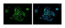 CDX-2 Mouse anti-Human, Unlabeled, Clone: M39-711, BD 0.1mg; Unlabeled:Antibodies,