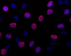 BrdU Mouse, Alexa Fluor 555, Clone: 3D4, BD 100 Tests | Buy Online | BD Biosciences | Fisher Scientific