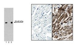 Cardiac Troponin T Mouse, Unlabeled, Clone: 13-11, BD 0.1 mg | Buy Online | BD Biosciences | Fisher Scientific
