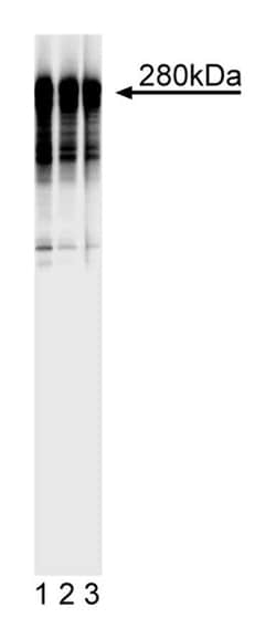 MAP2 Mouse, Unlabeled, Clone: AP20, BD 0.1mg; Unlabeled:Antibodies, Monoclonal