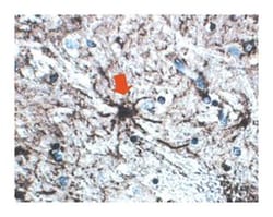 GFAP Mouse, Unlabeled, Clone: 4A11, 1B4, 2E1, BD 0.5mg; Unlabeled:Antibodies,