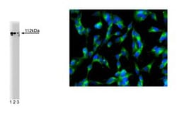 Adaptin Mouse, Unlabeled, Clone: 8, BD:Antibodies:Primary Antibodies