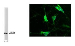 S100B Mouse, Unlabeled, Clone: 19, BD 50&mu;g; Unlabeled:Anticorps, Monoclonal