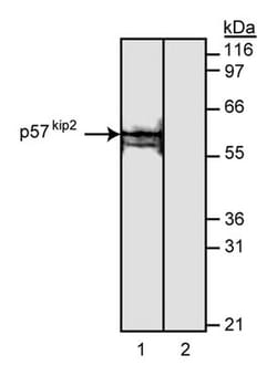 p57[Kip2] Mouse anti-Human, Unlabeled, Clone: A120-1, BD 0.1mg; Unlabeled:Antibodies,