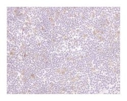 CD25 Rat anti-Mouse, Biotin, Clone: 7D4, BD 1mL; Biotin:Antibodies, Monoclonal