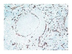 Panendothelial Cell Antigen Rat anti-Mouse, Unlabeled, Clone: MECA-32,