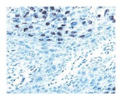 HPV-16 L1 Mouse anti-Human, Unlabeled, Clone: CAMVIR-1, BD 1mL; Unlabeled:Antikörper