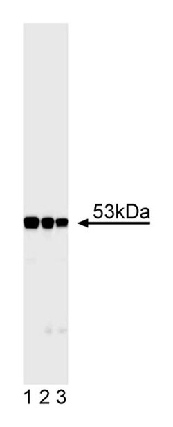 Anti-Desmin Mouse, Unlabeled, Clone: RD301, BD 50&mu;g; Unlabeled:Antibodies,