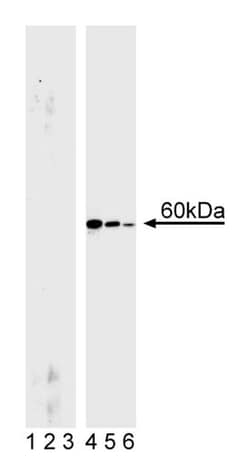 Akt (pS472/pS473) Mouse, Unlabeled, Clone: 104A282, BD 50 &mu;g | Buy Online | BD Biosciences | Fisher Scientific