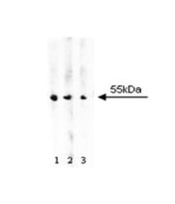 ALDH Mouse anti-Human, Unlabeled, Clone: 44, BD 150&mu;g; Unlabeled:Antibodies,