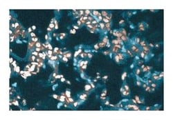 Brm Mouse, Unlabeled, Clone: 24, BD 50μg; Unlabeled:Antibodies, Monoclonal