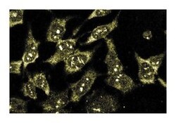 B2 Bradykinin Receptor Mouse, Unlabeled, Clone: 20, BD 150&mu;g; Unlabeled:Antibodies,