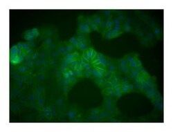 -Catenin Mouse, Alexa Fluor 488, Clone: 14/Beta-Catenin, BD 100 Tests;