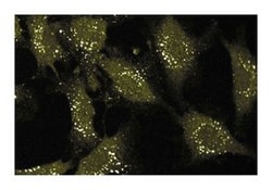 CD51 Mouse, Unlabeled, Clone: 21, BD:Antibodies:Primary Antibodies