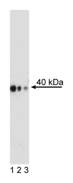 CDX-2 Mouse anti-Human, Unlabeled, Clone: M39-711, BD 0.1mg; Unlabeled:Antibodies,