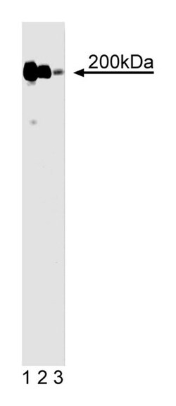 DNMT1 (DNA Methyl Transferase-1) Mouse anti-Human, Unlabeled, Clone: 18,