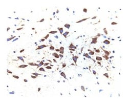 Dynamin II Mouse, Unlabeled, Clone: 27, BD 50μg; Unlabeled:Antibodies,