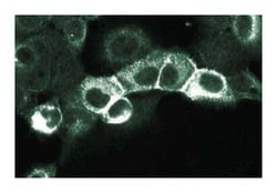 ErbB2 Mouse anti-Human, Unlabeled, Clone: 42, BD:Antibodies:Primary Antibodies