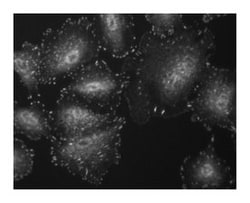 FAK (pY397) (Focal Adhesion Kinase) Mouse anti-Human, Unlabeled, Clone: