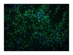 FoxA2 Mouse anti-Human, Unlabeled, Clone: N17-280, BD 0.1 mg | Buy Online | BD Biosciences | Fisher Scientific