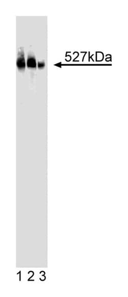 HERC2 Mouse, Unlabeled, Clone: 17, BD 50 &mu;g | Buy Online | BD Biosciences | Fisher Scientific