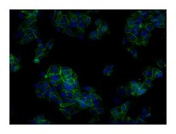 ASGPR 1 Mouse, Unlabeled, Clone: 8D7, BD 100&mu;g; Unlabeled:Antibodies,