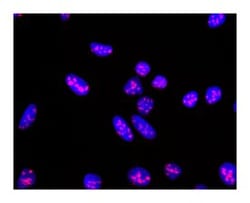 Ki-67 Mouse, Alexa Fluor 647, Clone: B56, BD 100 Tests; Alexa Fluor 647:Antibodies,