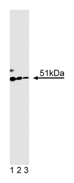 HNF-1 Mouse, Unlabeled, Clone: 25, BD 50&mu;g; Unlabeled:Antibodies, Monoclonal
