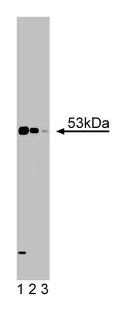 LCB1 Mouse, Unlabeled, Clone: 49, BD 150&mu;g; Unlabeled:Antibodies, Monoclonal